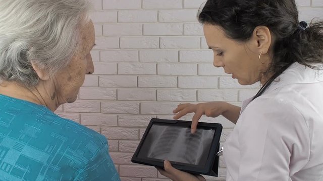 The doctor advises an elderly woman. The doctor shows the patient on the tablet X-Ray on it.