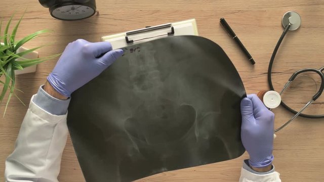Doctor examining x-ray of the patient's pelvis bone in a medical clinic. Healthcare professional analyzing imaging test for pelvic fractures.