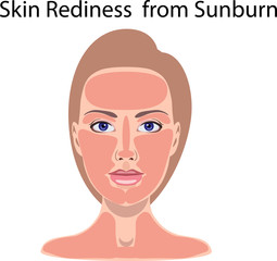 Vector face with burnt skin