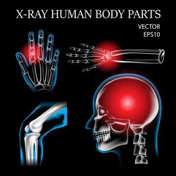 X-ray Human body parts
