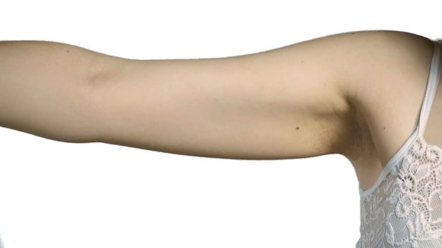 Woman's flabby triceps