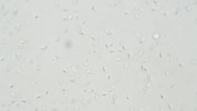 Human spermatozoa under microscope. Testing in laboratory
