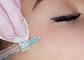 The doctor cosmetologist makes the Rejuvenating facial injections procedure for tightening and smoothing wrinkles on the face skin of a beautiful, young woman in a beauty salon.Cosmetology skin care.