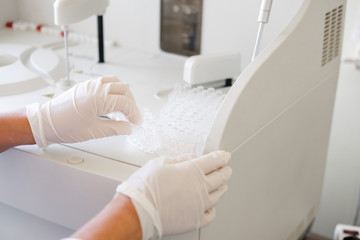 researcher doing research in a lab. Scientist doing chemical test in laboratory. Doctor doing medical analysis on machine. Close up