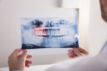 Doctor Holding Teeth X-ray