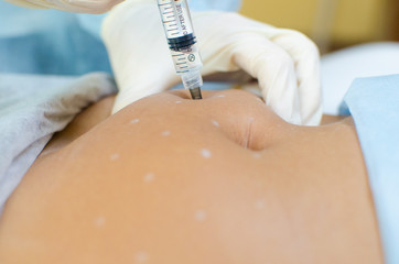 Injections from cellulite. A young woman removes cellulite with the help of medicine
