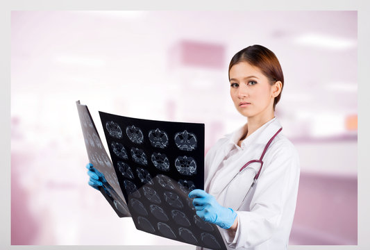 Female Doctor looking at a tomography x-ray picture of Eyes.