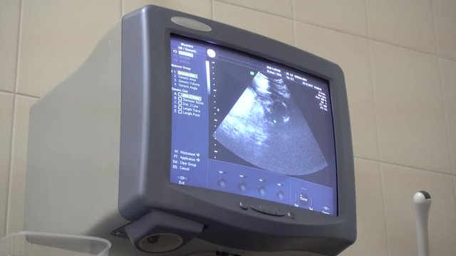 Ultrasonography of heartbeat of the small baby in 4k