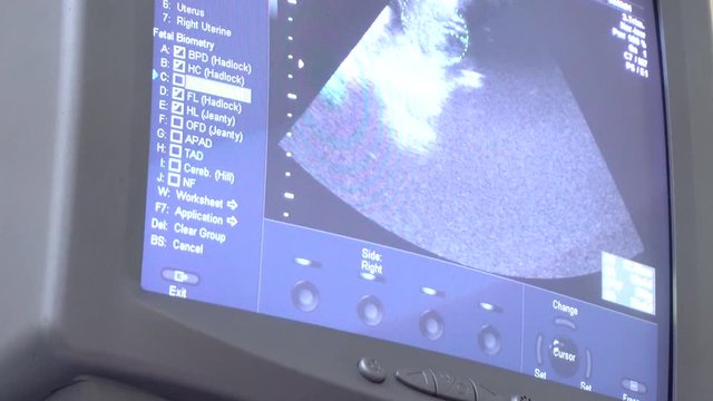 ultrasonography of the small baby in 4k