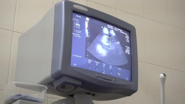 Image of female womb on monitor ultrasound examination equipment. Diagnosis of a person in the clinic.