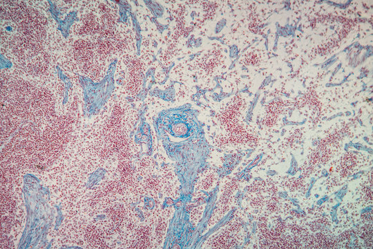 Lymphknoten Gewebe unter dem Mikroskop 100x
