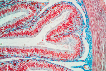 Darm Gewebe unter dem Mikroskop 200x