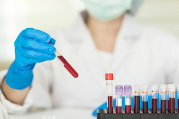 Female Technician holding blood tube test, a rack of  blood samples Tubes of patients in laboratory in the hospital.