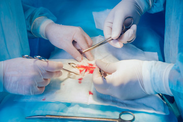 Group of surgeons in operating room with surgery equipment.