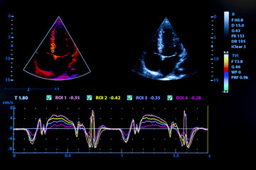 Colourful image of homan heart ultrasound monitor - Powered by Adobe