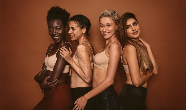 Female models with different skins