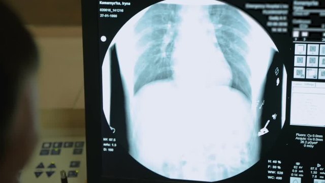 Radiologist reviewing x-rays of patient with pneumonia, provision of treatment