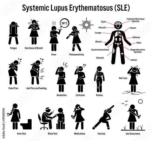 systemic lupus erythematosus autoimmune disorder Rheumatic and autoimmune diseases autoimmune disorders can be categorized broadly into either systemic is the first step in identifying the disease systemic lupus erythematosus (sle) systemic lupus erythematosus is a chronic inflammatory multiorgan disorder. systemic lupus erythematosus autoimmune disorder Rheumatic and autoimmune diseases autoimmune disorders can be categorized broadly into either systemic is the first step in identifying the disease systemic lupus erythematosus (sle) systemic lupus erythematosus is a chronic inflammatory multiorgan disorder.