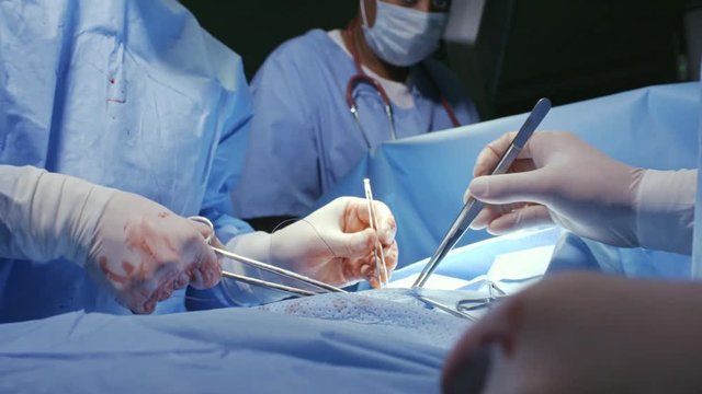 PAN with mid-section of surgeons in scrubs and masks stitching incision during operation