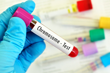 Blood sample for chromosome test
