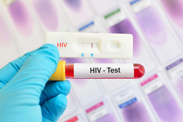 Fototapeta premium Rapid card test for HIV testing