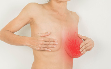 Breast with tumor inside And have an abnormal chest.