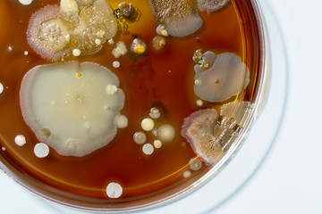 A petri dish with colonies of microorganisms for bacteriological analysis in a microbiological...