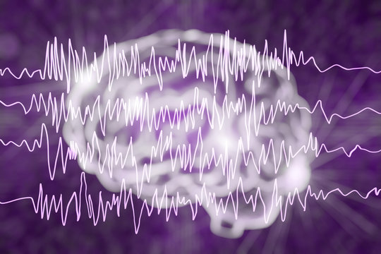 Epilepsy awareness concept. Brain and encephalography in epilepsy patient during seizure attack, 3D illustration in purple color
