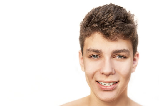Portrait of a teenager on a white background. There are braces on his teeth, but they do not have a special wire