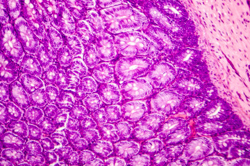 Histology of human appendix, micrograph showing Crypts of Lieberkuhn. Photo under microscope