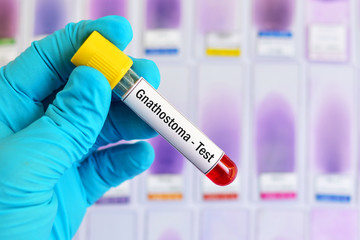 Test tube with blood sample for Gnathostoma parasite test