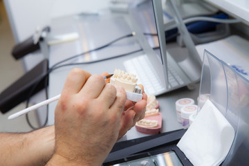 dental technician's hands