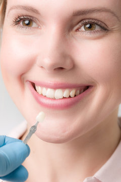 Zahnfarbe wird an einem Frauenmund mit einer Zahnfarbprobe abgeglichen