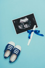 top view of arrangement of childish shoes, ultrasound scan and pregnancy test with ribbon isolated on blue
