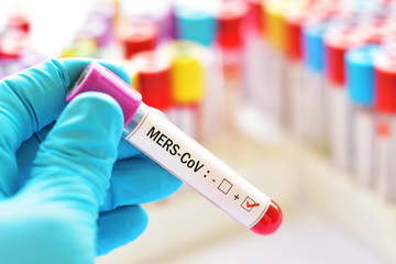 Fototapeta premium Blood sample positive with MERS-CoV (Middle East respiratory syndrome coronavirus)