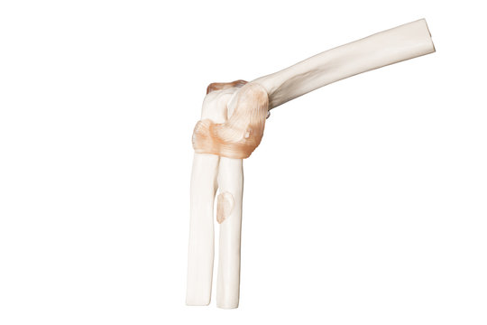 Orthop&auml;die Skelett vom Ellenbogengelenk mit B&auml;ndern Oberarmknochen, Elle und Speiche Seitlich Au&szlig;en