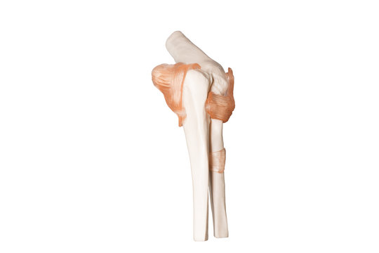 Orthopädie Skelett vom Ellenbogengelenk mit Bändern Oberarmknochen, Elle und Speiche Rückseite