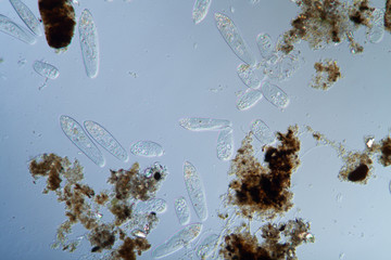 Plankton mit Ciliaten
