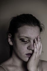 Sad woman with bruise on her face
