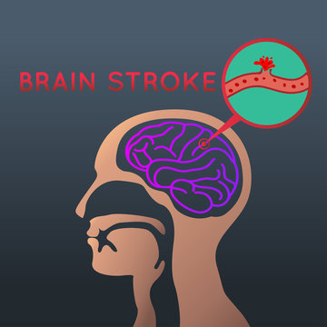 brain stroke icon design. logo vector illustration