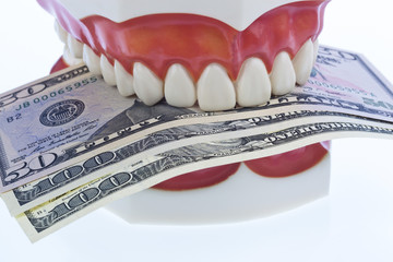 teeth model with dollar bills