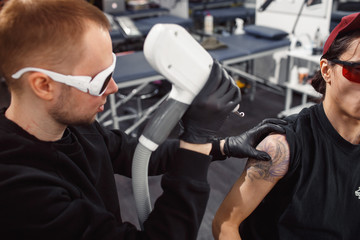 laser tattoo removal from arm