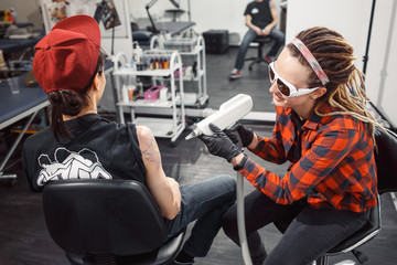 laser tattoo removal from arm