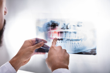 Dentist Examining Teeth X-ray