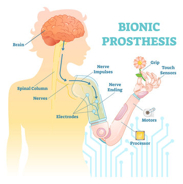 Bionic Prosthesis - Robotic Female Hand 