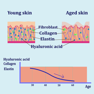 Vector diagram with schemes of two types of skin, for cosmetological illustrations