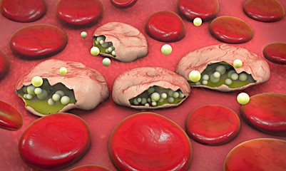 3d illustration of blood cells, plasmodium causing malaria illne
