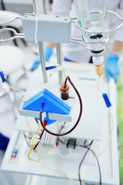 Procedure Plasmapheresis - The Procedure Of Purification Of Blood And Plasma From Toxins