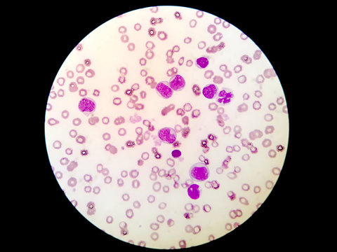 Human blood smear under microscope