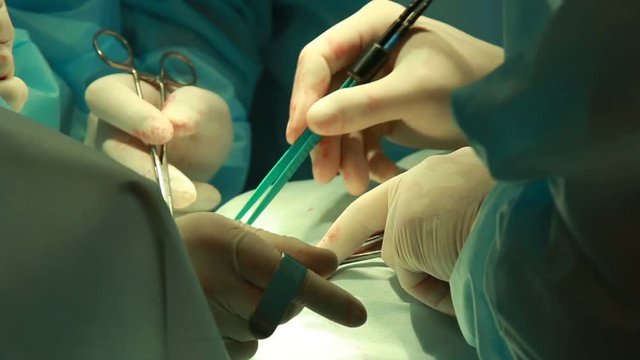 real surgery team operating throat adenoma close up